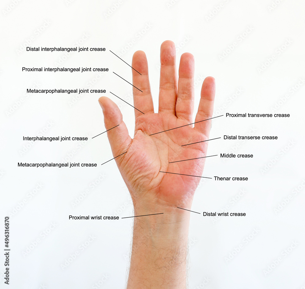 Diagram of Hand lines and flexion creases on the right palm with the