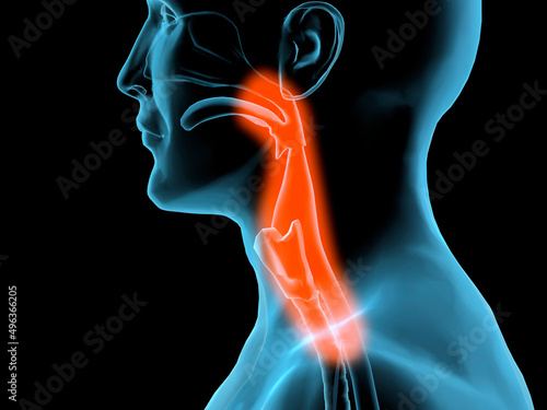 Close-up of a person with a soar throat photo