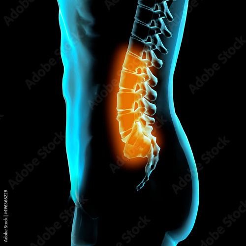 X-ray image of a human lumbar vertebra photo