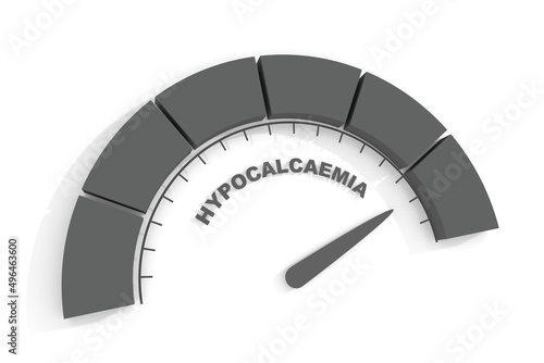 Hypocalcaemia measuring. Hypocalcemia is a low calcium level in the blood serum. 3D render photo