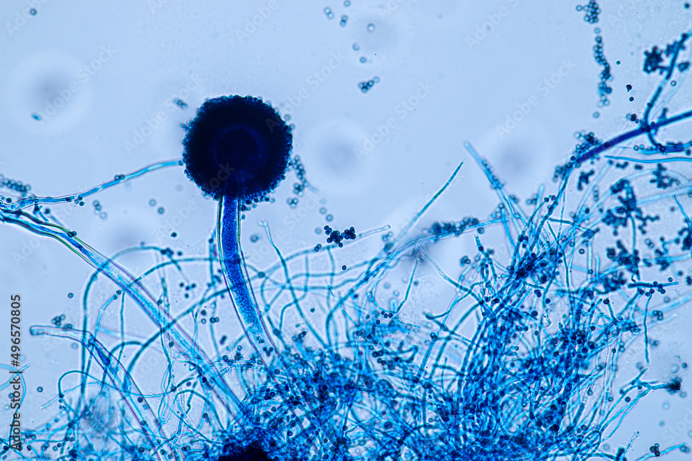 Aspergillus niger and Aspergillus oryzae (mold) under microscope for  Microbiology in Lab. Stock Photo | Adobe Stock