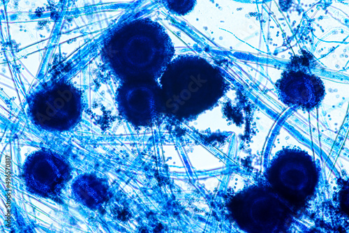 Aspergillus niger and Aspergillus oryzae (mold) under microscope for Microbiology in Lab. 