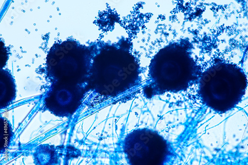 Aspergillus niger and Aspergillus oryzae (mold) under microscope for Microbiology in Lab. 