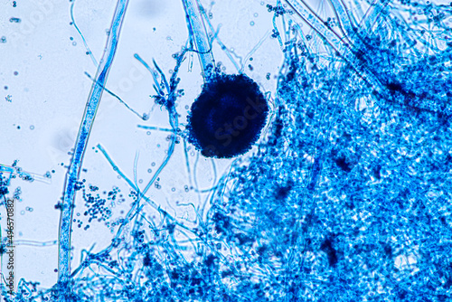 Aspergillus niger and Aspergillus oryzae (mold) under microscope for Microbiology in Lab. 
