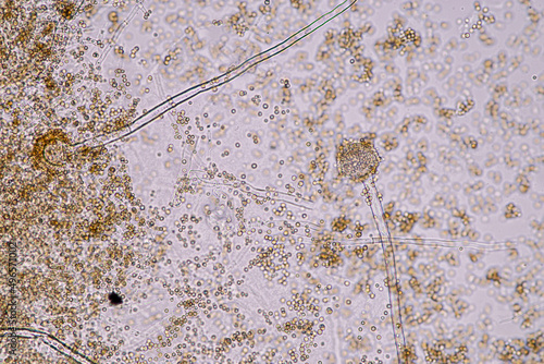 Aspergillus niger and Aspergillus oryzae  (mold) under microscope for Microbiology in Lab.
 photo