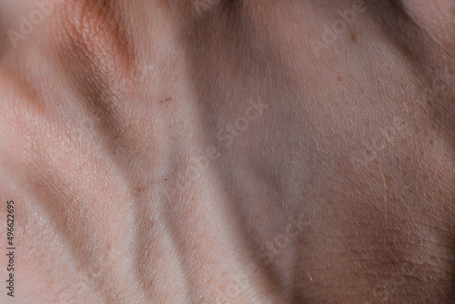 Skin texture of caucasian hand  veins  hair  pores  scratches. Macro photo