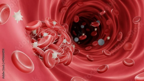 Animation of a blood clot forming in a blood vessel photo