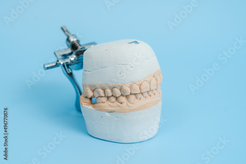 Dental tooth dentistry student learning teaching model showing teeth, roots, gums, gum disease, tooth decay and plaque