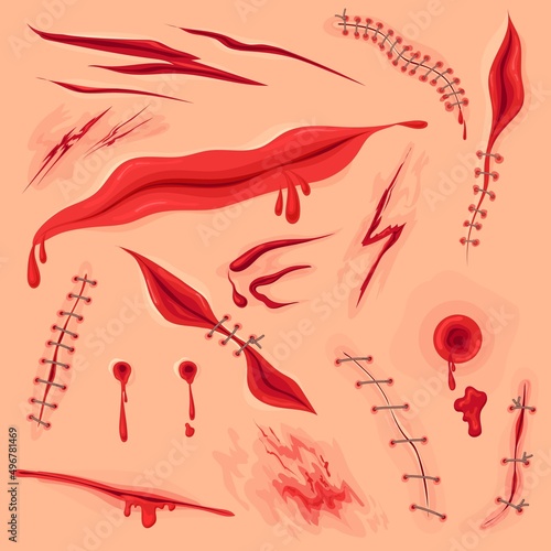 Skin incision wound. Bloody surgery stitch scar or cut on body, lacerated wounded texture, injured skins red mark pain gash hurt halloween horror