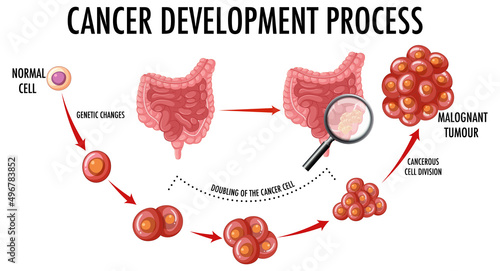 Diagram showing normal and cancer cells in human