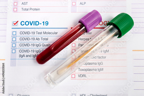 Blood tube and nasal swab laboratory test with requisition form for analysis of Covid-19 or coronavirus in hospital. Tubes with nasal fluid and blood sample from a patient for molecular tests and pcr 