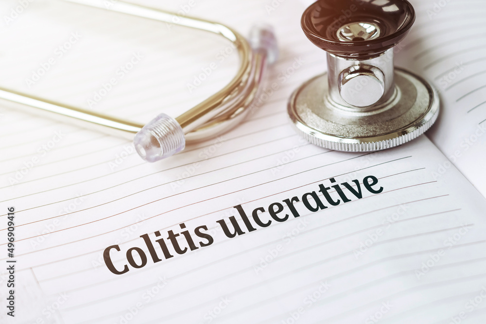Ulcerative colitis written in an open notebook with stethoscope. Ulcerative colitis written in an open notebook with stethoscope.