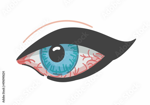 Redness of the eye. Eyeball disease. Vector illustration. Isolated icon. Cartoon style. Conjunctivitis.