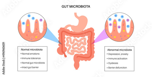 Human gut microbiota