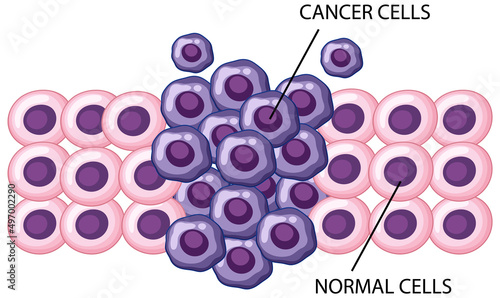 Process of cancer cell development