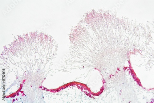 Monilinia fructigena under the microscope photo