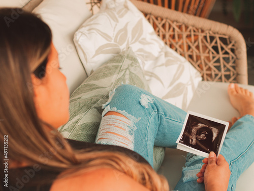 Bilde på lerret Beautiful pregnant woman watching the echo of her baby