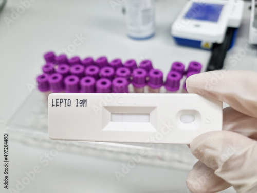 A rapid Kit for detection of IgM against Leptospira in human. Hand of a scientist holding a Leptospira antibody test kit . negative test result.