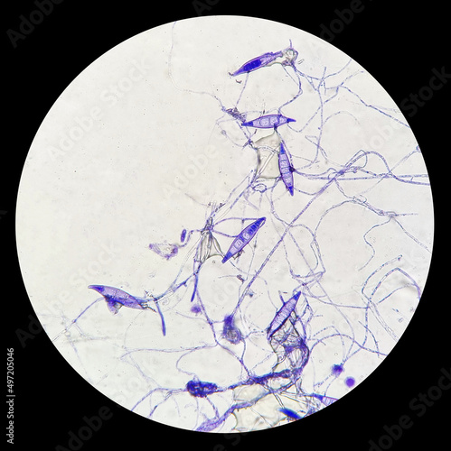 Microscopic finding shows macroconidia of Microsporum canis in dog with skin disease. a ringworm infection in pets. photo