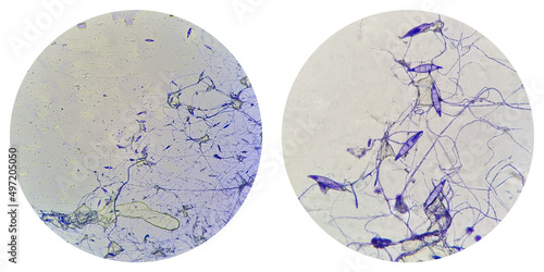 Microscopic finding shows macroconidia of Microsporum canis in dog with skin disease. a ringworm infection in pets.