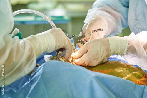 the hands of a surgeon and an assistant perform a surgical operation with special tools close-up on gloved hands
