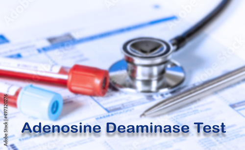 Adenosine Deaminase Test Testing Medical Concept. Checkup list medical tests with text and stethoscope photo