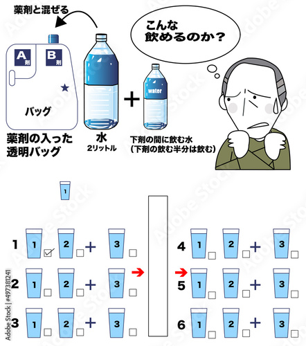 大腸検査の下剤で準備方法