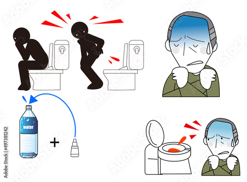 内視鏡で大腸からの出血の検査