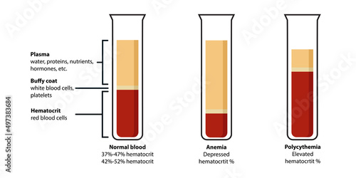 Composition of blood: plasma, buffy coat, hematocrit. Сorrelation between red blood cells (erythrocytes), white blood cells (leukocytes), proteins, hormones defines normal blood, anemia, polycythemia