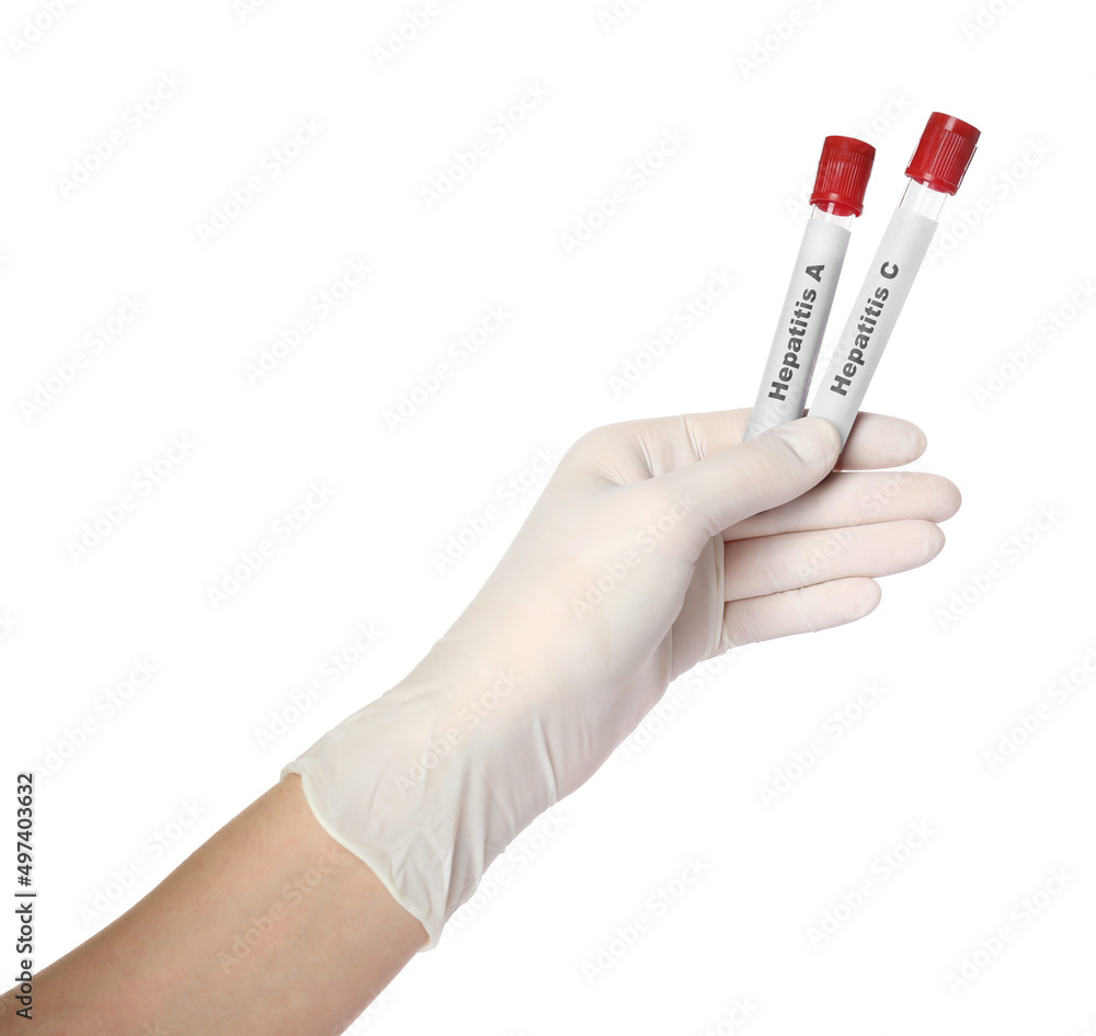 Scientist holding tubes with blood samples for hepatitis virus test on white background, closeup Scientist holding tubes with blood samples for hepatitis virus test on white background, closeup