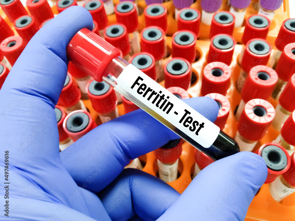 Blood sample for Ferritin level test at medical laboratory. Stock Photo