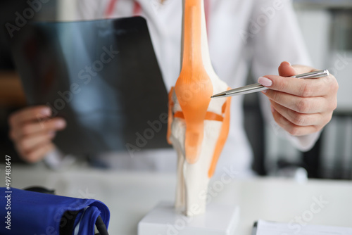 Doctor traumatologist examines x-ray and legs and the model of knee joint photo