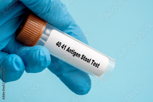 40 41 Antigen Stool Test photo