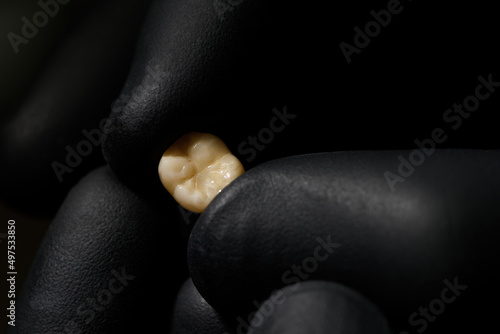 Close-up shot of a denture. Ceramic tooth crown in the hands of an orthopedic dentist. Doctor's hands in black gloves hold the crown of the implant. Dental technologies. Implantation and prosthetics. photo