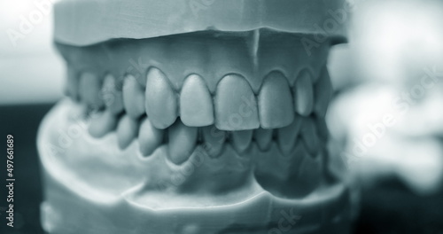 Wallpaper Mural Upper and lower jaw of a man printed on a 3d printer of photopolymer. Stereolithography 3D printer, technology of liquid photopolymerization under UV light. Modern medical technologies Torontodigital.ca