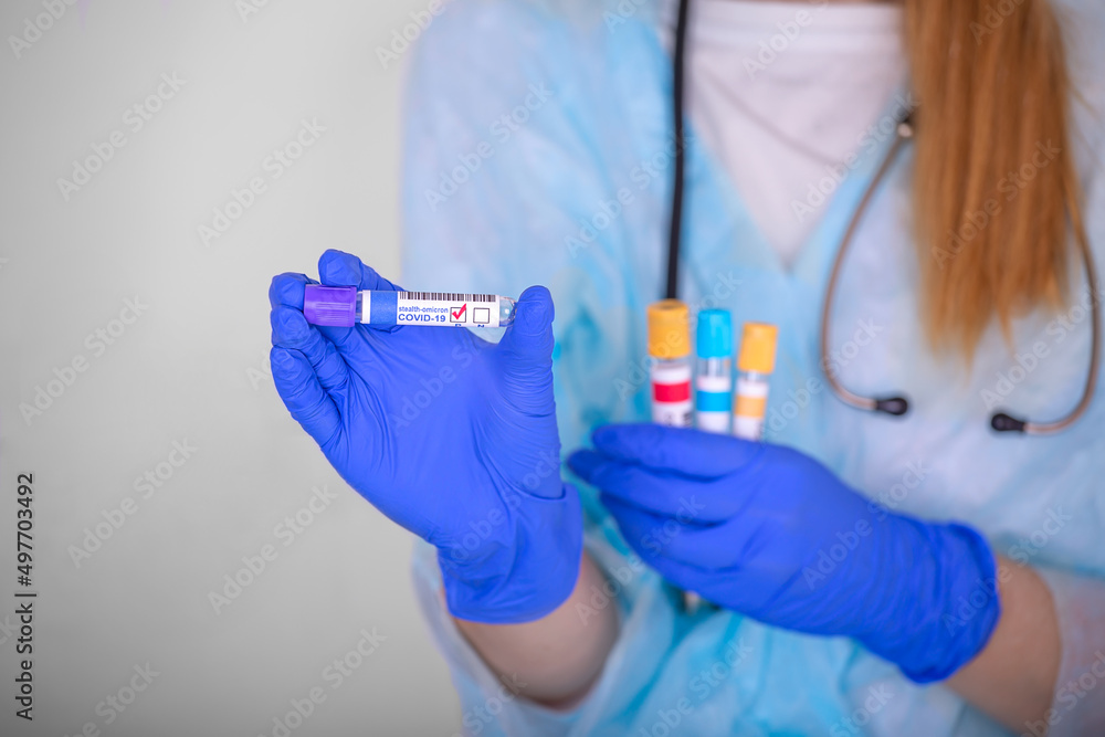 A girl, a medical worker, shows a test tube with a positive test result for covid-19 stealth omicron, close-up A girl, a medical worker, shows a test tube with a positive test result for covid-19 stealth omicron, close-up