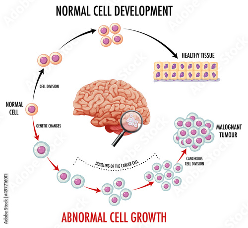 Diagram showing normal cell development