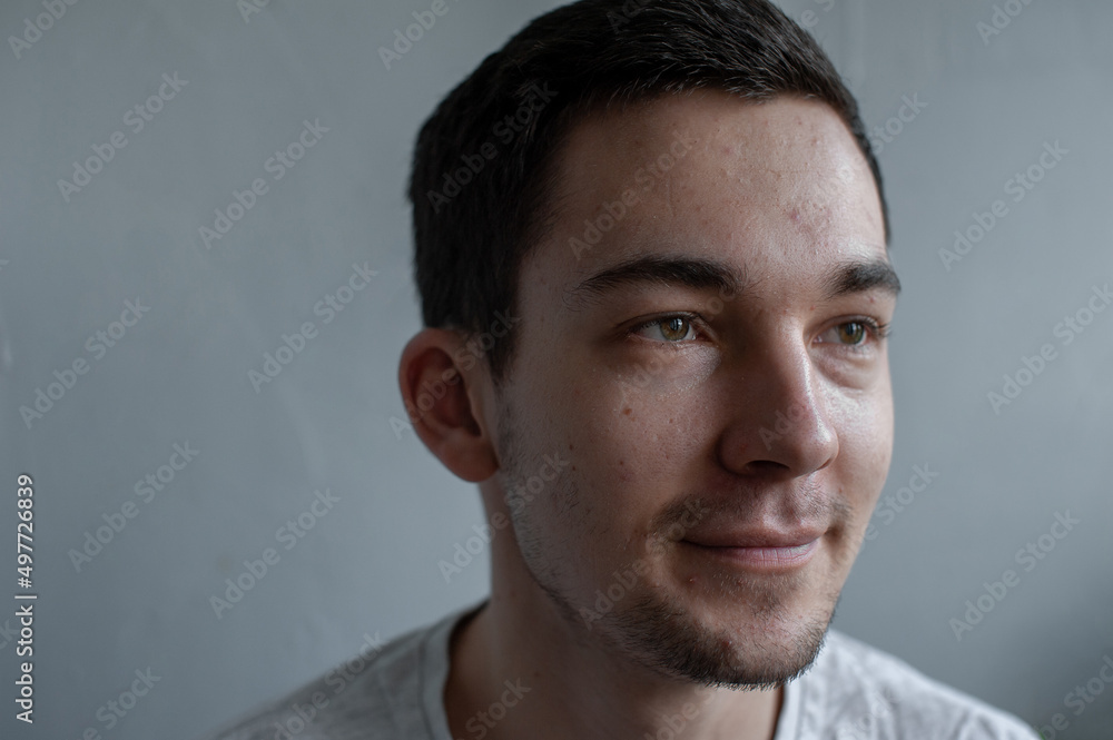 Young man struggling with acne on his face caring for his skin pushes acne Young man struggling with acne on his face caring for his skin pushes acne