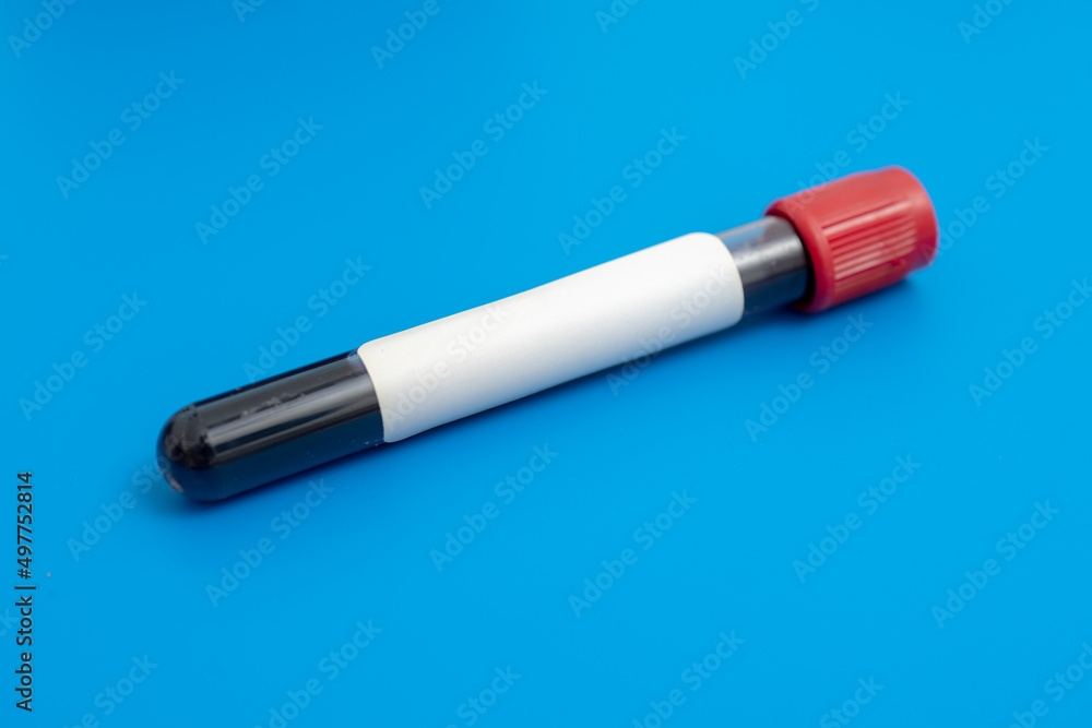 Test tube with empty label to biological sample for medical laboratory research on blue background Test tube with empty label to biological sample for medical laboratory research on blue background