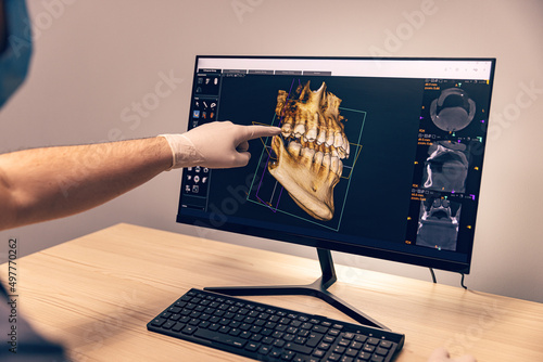 Fotografie Digital screen in dental clinic