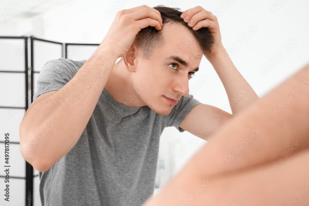 Young brunette man with hair loss problem near mirror in bathroom Young brunette man with hair loss problem near mirror in bathroom