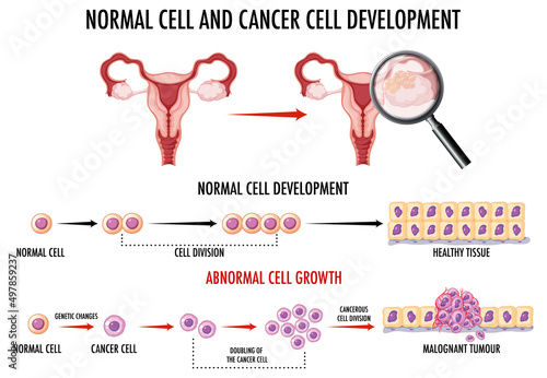 Diagram showing normal and cancer cell