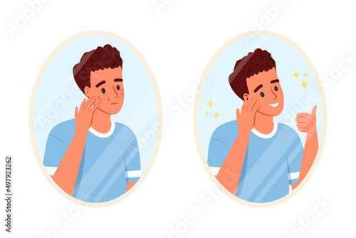 Skin care concept. Teenage boy before and after acne treatment procedure: pimples, blackheads and healthy skin. Young guy looking in bathroom mirror. Teenager skin. Flat cartoon vector illustration.