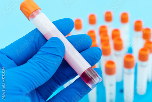 Hand holing a blood test tube with blank label