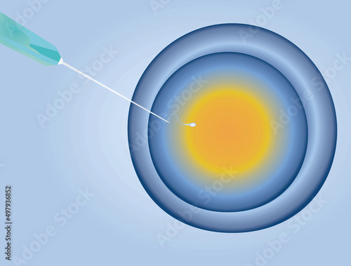 IVF insemination fertility. vector illustration