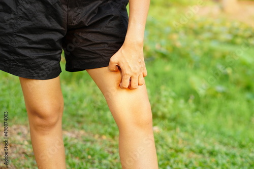 Woman wearing shorts itchy legs Scratch with your hands to relieve itching.