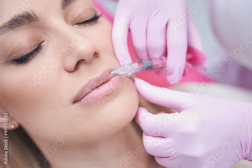 Patient receiving filler injection into her upper lip