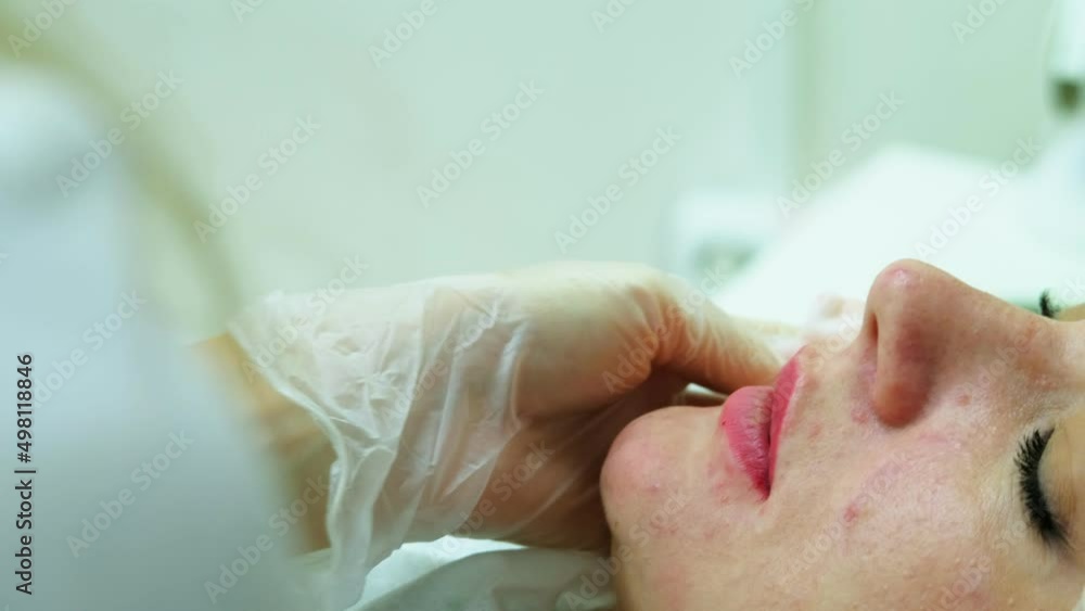 The cosmetologist makes injections on the client's face in the lip area The cosmetologist makes injections on the client's face in the lip area