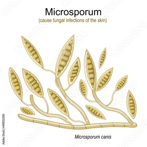 Microsporum, under microscope. Microscopic fungi
