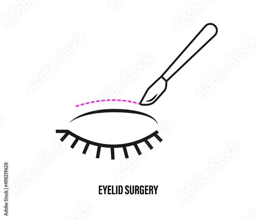 eyelid surgery. vector icon. Eyelid plastic surgery. Eye lift surgery. Surgical facial rejuvenation.